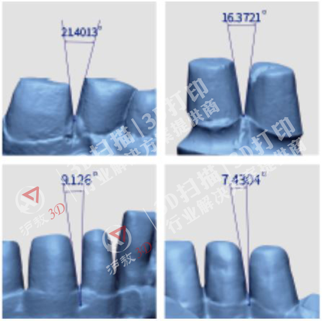 【上海沪敖3D】三维扫描在公共安全领域的应用⑤-5、人牙咬痕个体识别
